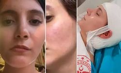 Diş ağrısıyla başlayan acı beyninde bitti
