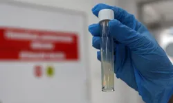 Dünyanın en ölümcül hastalığı 1,23 milyon can aldı