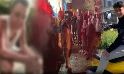 Kuaförde dehşet: 14 yaşındaki çocuğun tüm vücudu yandı!