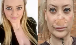 Antalya tatilinde dişlerini yaptıran turistin burnu çöktü!