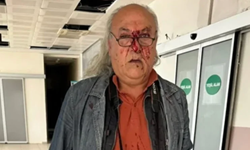 CHP'li Belediye'nin korumalarından gazeteciye darp