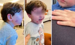 Minik Çocuk Kreşte Kâbusu Yaşadı