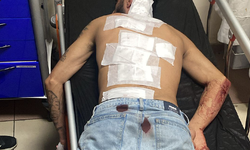 Sosyal Medya Tartışması Kanlı Bitti