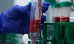 Köyde Virüs Bulaşan Adam Hayatını Kaybetti