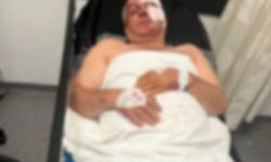 Aydın’da Kan Donduran Olay! Husumetli Olduğu Kardeşini Ağrı Yaraladı