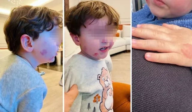 Minik Çocuk Kreşte Kâbusu Yaşadı