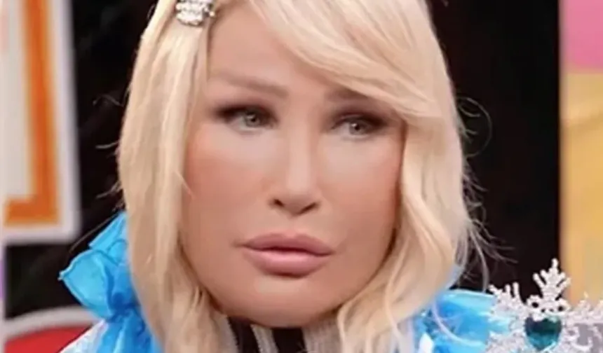 Seda Sayan yüzündeki şişliğin nedenini açıkladı