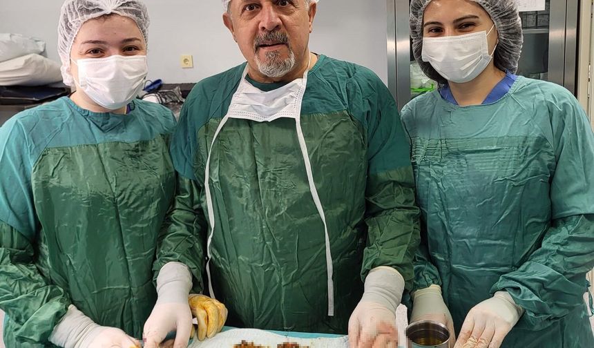 Karın ağrısıyla gitti, safrasından binlerce taş çıktı